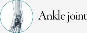 Ankle Joint