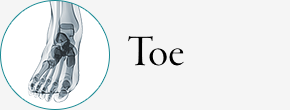 Toe